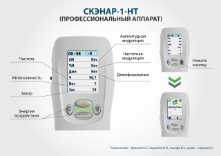 СКЭНАР-1-НТ (исполнение 01)  в Владикавказе купить Скэнар официальный сайт - denasvertebra.ru 